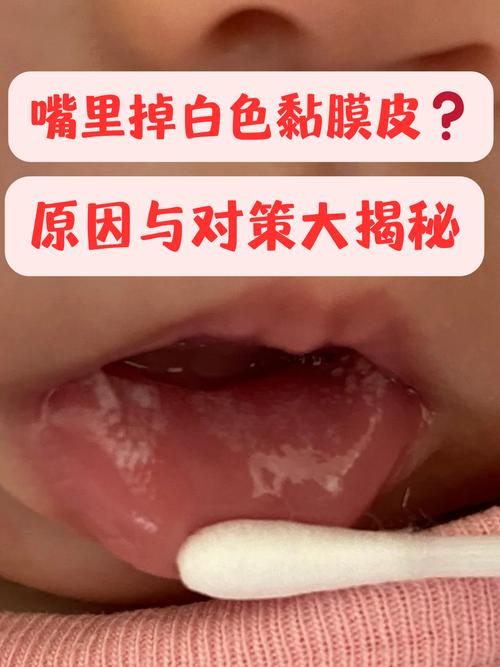 儿童嘴唇发白是贫血还是疾病信号？家长该如何应对？-第1张图片-郑州医学网