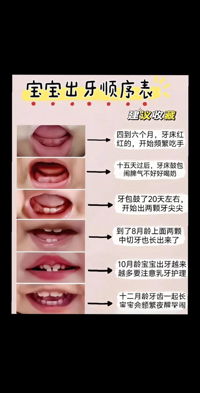 新生儿长牙是早熟还是异常？背后的发育信号你读懂了吗？-第2张图片-郑州医学网