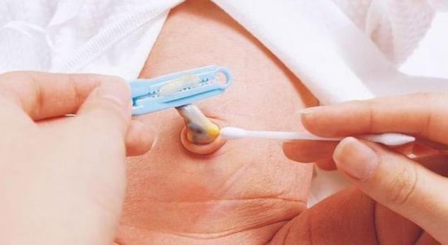 新生儿肚脐出现黄色分泌物是正常现象还是感染信号？需如何处理？-第3张图片-郑州医学网