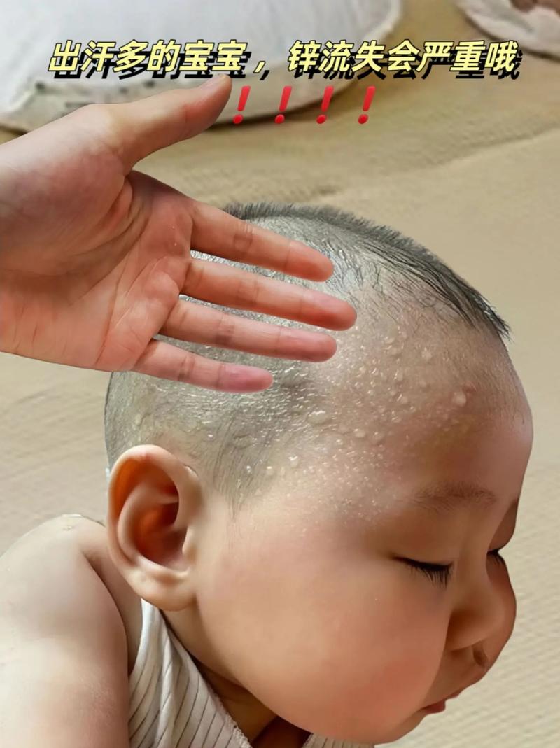 新生儿头部出汗多是缺钙还是正常生理现象？需警惕哪些潜在问题？-第3张图片-郑州医学网
