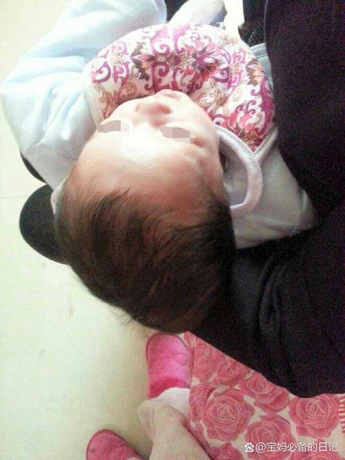 新生儿颅内感染有哪些容易被忽视的早期症状？-第3张图片-郑州医学网