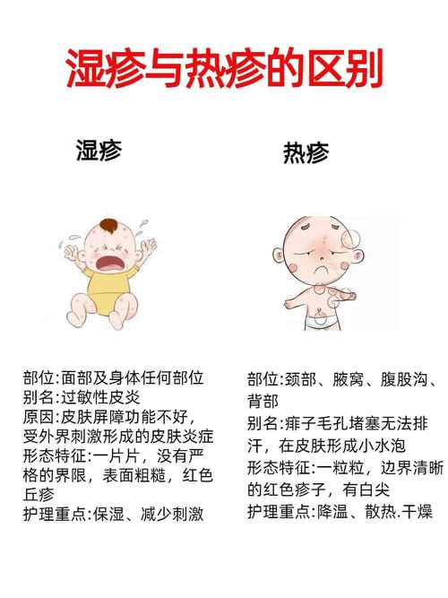 新生儿腿上湿疹反复发作,到底该如何科学护理与治疗?-第1张图片-郑州医学网 新生儿腿上湿疹反复发作,到底该如何科学护理与治疗?-第1张图片-郑州医学网