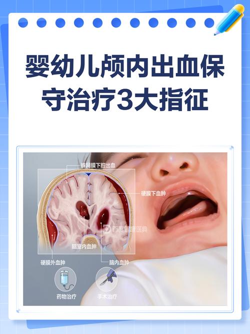新生儿颅内出血的分级标准具体是什么?不同级别对应的治疗方案有何差异?-第3张图片-郑州医学网 新生儿颅内出血的分级标准具体是什么?不同级别对应的治疗方案有何差异?-第3张图片-郑州医学网