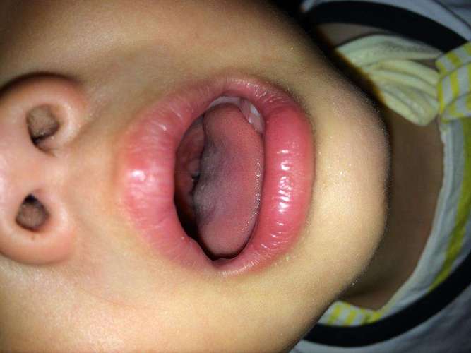 新生儿嗓子里感觉有痰，是正常现象还是生病了？需要家长注意什么？-第1张图片-郑州医学网