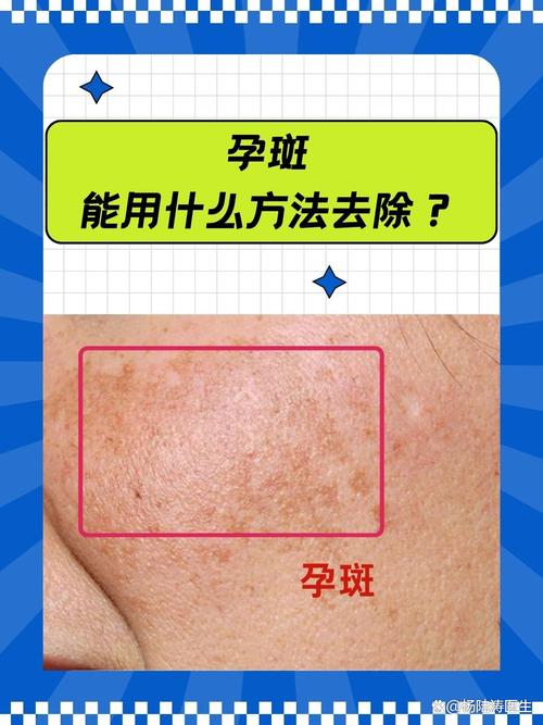 孕期色斑加重怎么调理-第2张图片-郑州医学网