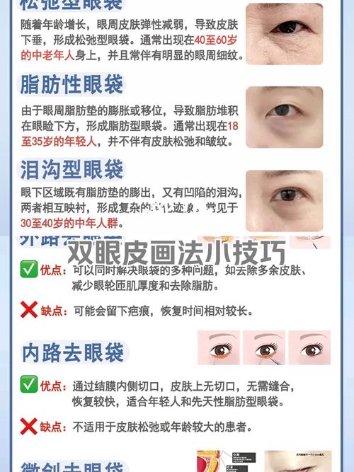 孕期眼袋悄悄找上门？揭秘激素变化与血液循环的双重影响！-第2张图片-郑州医学网