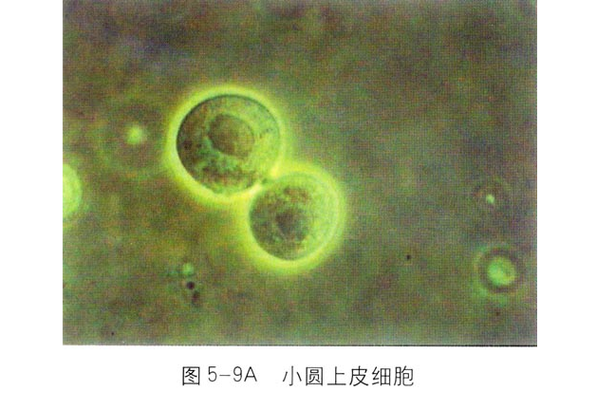 孕期小圆上皮细胞偏高，是炎症信号还是生理波动？需干预吗？-第2张图片-郑州医学网