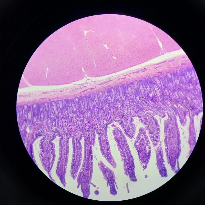孕期小圆上皮细胞偏高，是炎症信号还是生理波动？需干预吗？-第3张图片-郑州医学网