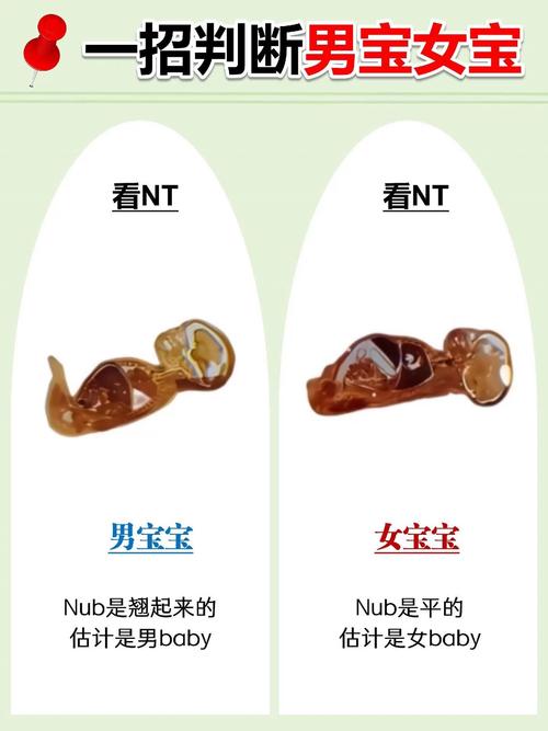 孕期胎儿性别与胎动频率有关吗?男宝胎动真的更频繁吗?-第3张图片-郑州医学网 孕期胎儿性别与胎动频率有关吗?男宝胎动真的更频繁吗?-第3张图片-郑州医学网