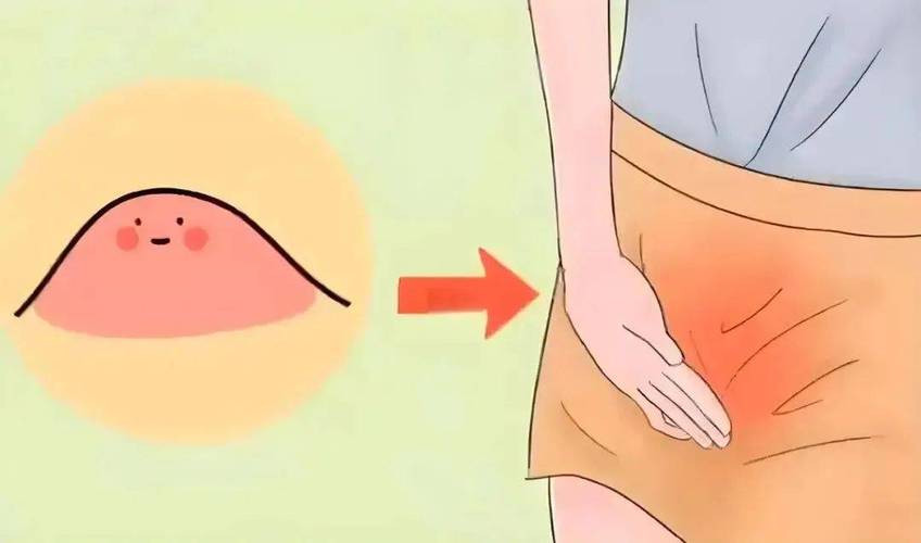 孕期外阴肿胀是正常生理变化还是危险信号？需警惕哪些潜在问题？-第1张图片-郑州医学网