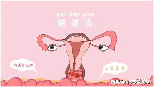 孕期外阴胀痛怎么回事-第3张图片-郑州医学网