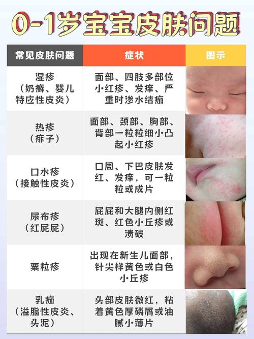 新生儿宫内感染会有哪些异常症状?家长该如何早期识别与应对?-第1张图片-郑州医学网 新生儿宫内感染会有哪些异常症状?家长该如何早期识别与应对?-第1张图片-郑州医学网