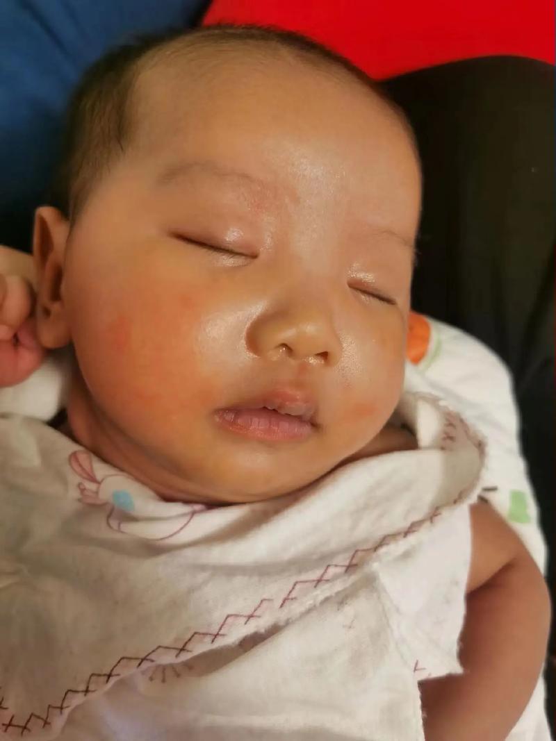 儿童面色发黄是营养不良还是肝脏问题？需警惕哪些潜在疾病信号？-第2张图片-郑州医学网