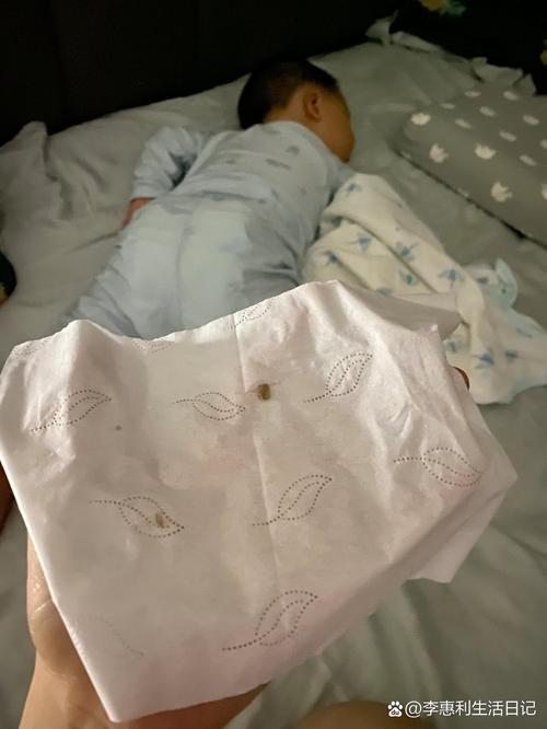 新生儿鼻腔为何总有鼻屎？是正常现象还是生病信号？-第3张图片-郑州医学网