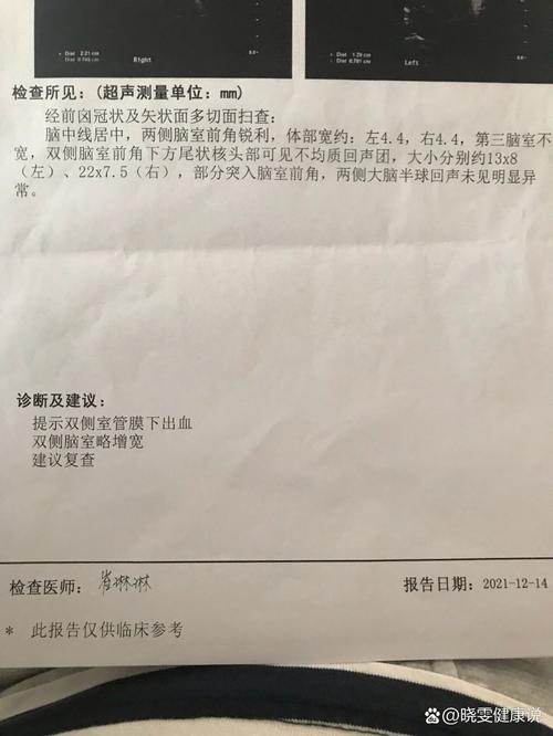 新生儿脑出血后复查时间间隔是多久？不同严重程度复查周期有何差异？-第3张图片-郑州医学网