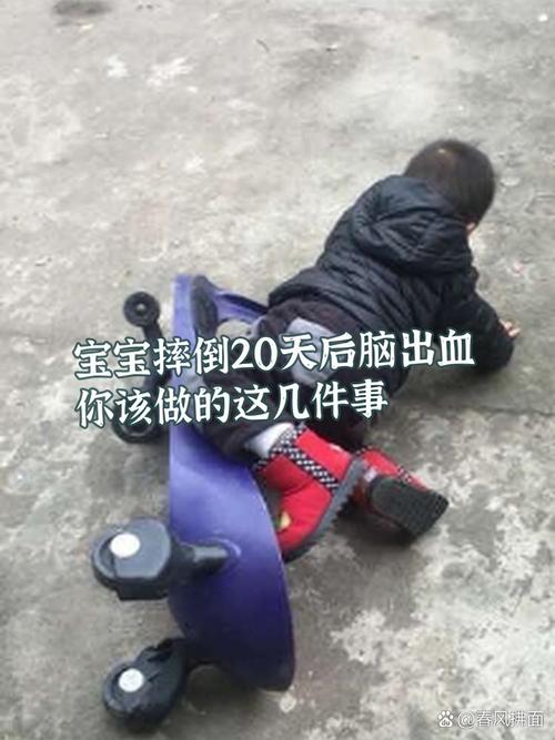 新生儿脑出血后复查时间间隔是多久？不同严重程度复查周期有何差异？-第1张图片-郑州医学网