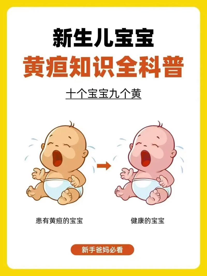 新生儿10天黄疸21mg/dl需要立即干预吗？-第1张图片-郑州医学网