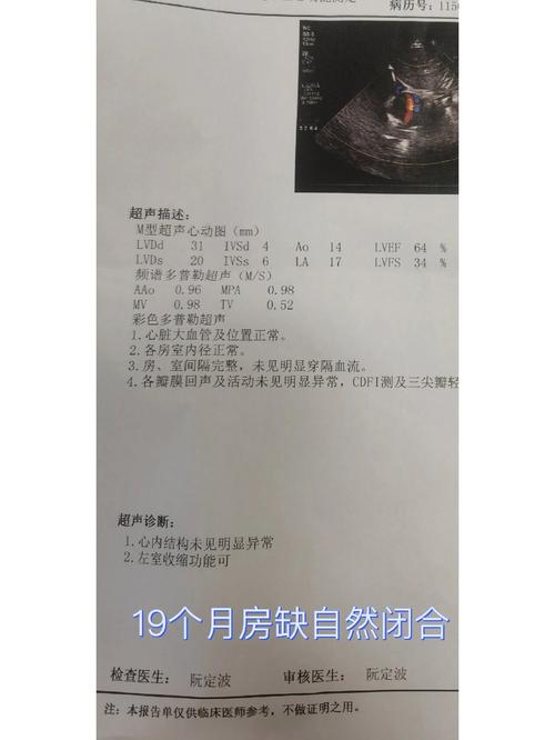 新生儿房间隔缺损都会自愈吗?需要家长注意哪些关键问题?-第2张图片-郑州医学网 新生儿房间隔缺损都会自愈吗?需要家长注意哪些关键问题?-第2张图片-郑州医学网