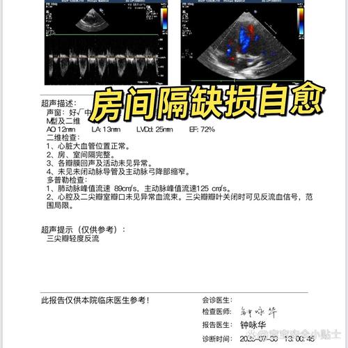 新生儿房间隔缺损都会自愈吗?需要家长注意哪些关键问题?-第1张图片-郑州医学网 新生儿房间隔缺损都会自愈吗?需要家长注意哪些关键问题?-第1张图片-郑州医学网