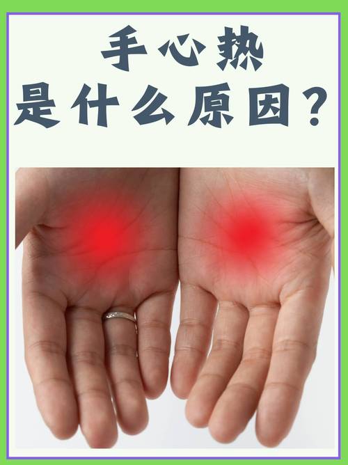 儿童手心发热是正常现象还是疾病信号？需关注哪些伴随症状？-第1张图片-郑州医学网