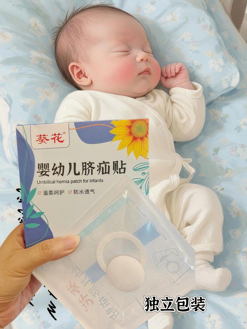 新生儿脐疝一定要手术吗？有哪些非手术治疗方法有效？-第2张图片-郑州医学网