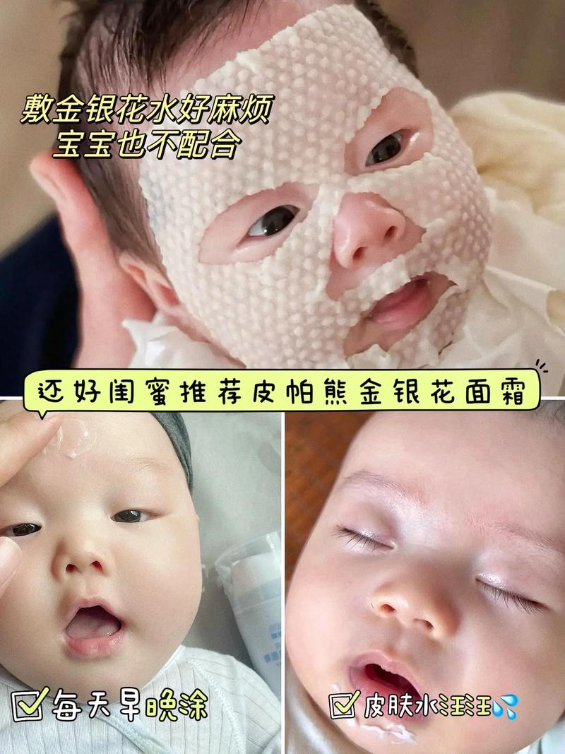 新生儿脸上湿疹抹什么-第1张图片-郑州医学网