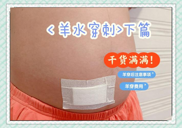 孕期做穿刺检查具体是查什么？这项检查对胎儿和孕妇有哪些风险与必要性？-第3张图片-郑州医学网