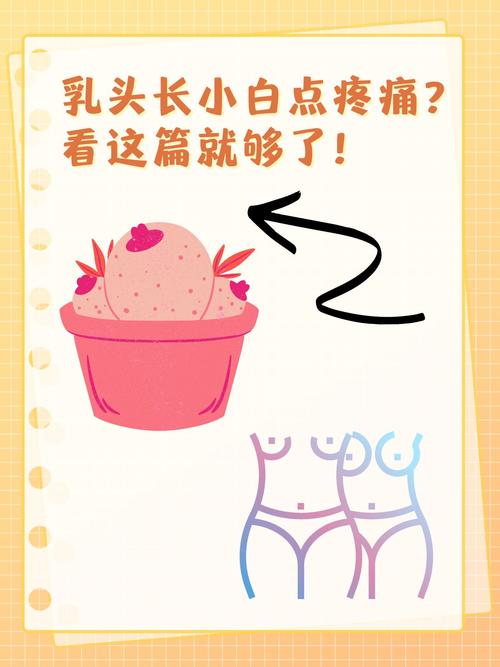 孕期乳头出现白色分泌物是正常现象吗？需要处理吗？-第3张图片-郑州医学网