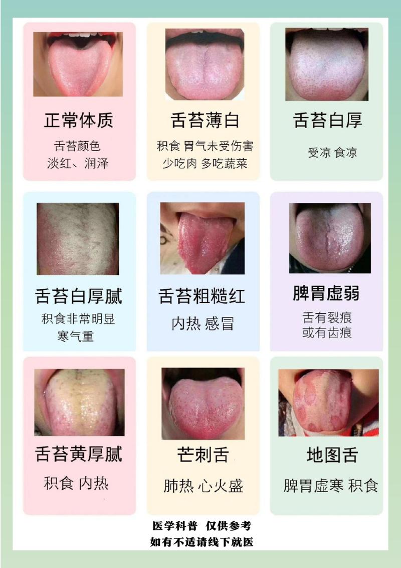 儿童舌头健康状态图鉴，如何通过图片区分正常与异常？-第1张图片-郑州医学网