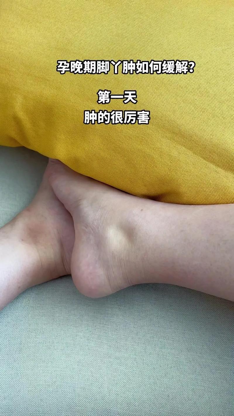 孕期脚浮肿到底能不能按摩？按摩方法不当会有风险吗？-第3张图片-郑州医学网