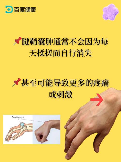 儿童腱鞘囊肿反复发作，家长该如何科学缓解与预防？-第3张图片-郑州医学网