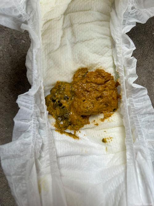 新生儿总是晚上拉大便-第1张图片-郑州医学网