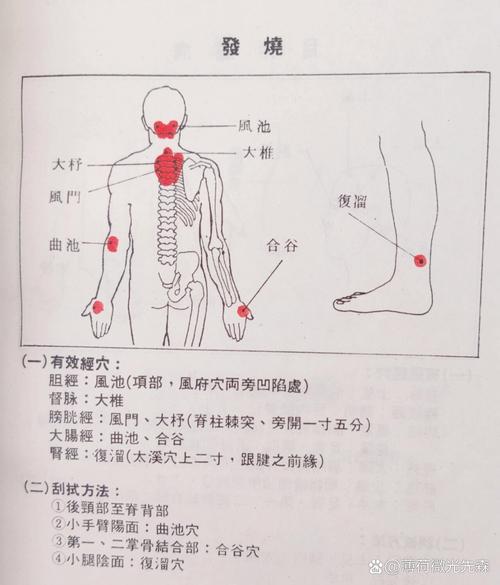 儿童发烧刮痧方法图片-第2张图片-郑州医学网
