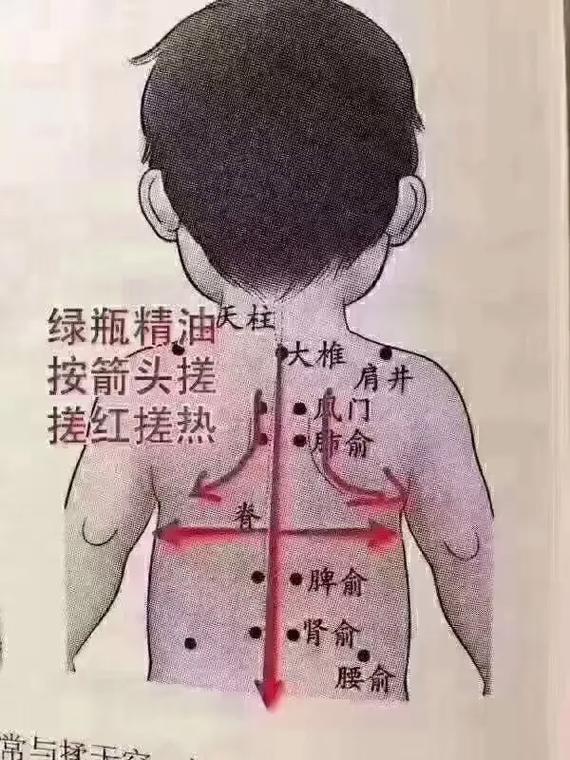 儿童发烧刮痧方法图片-第3张图片-郑州医学网
