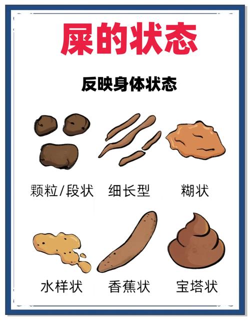 孕期大便次数多不成形是正常生理变化还是肠道疾病信号？-第1张图片-郑州医学网