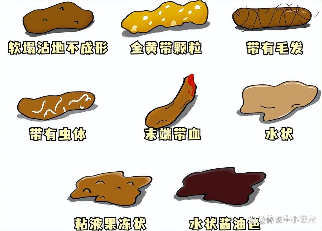 孕期大便次数多不成形是正常生理变化还是肠道疾病信号？-第2张图片-郑州医学网