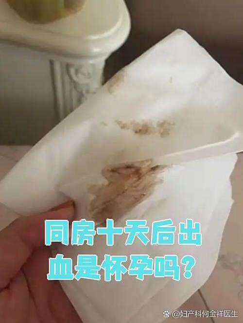 孕期同房后出血，是正常现象还是危险信号？原因有哪些？需要注意什么？-第3张图片-郑州医学网