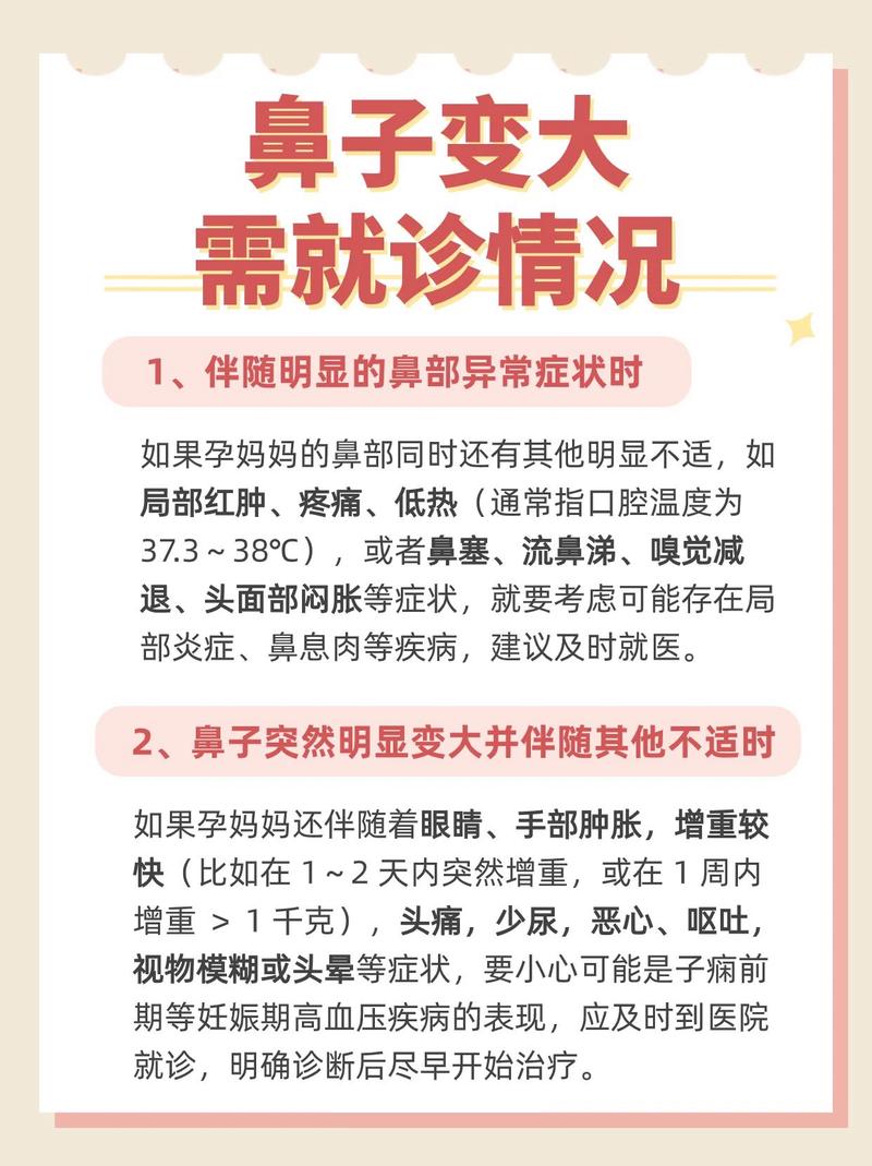 孕期为什么鼻子会变大-第1张图片-郑州医学网