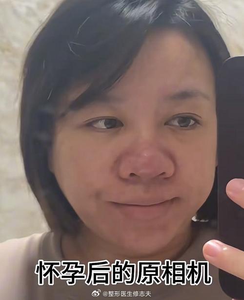 孕期为什么鼻子会变大-第2张图片-郑州医学网