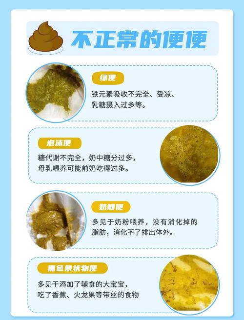 新生儿大便呈块状是消化不良还是喂养方式出了问题？-第2张图片-郑州医学网