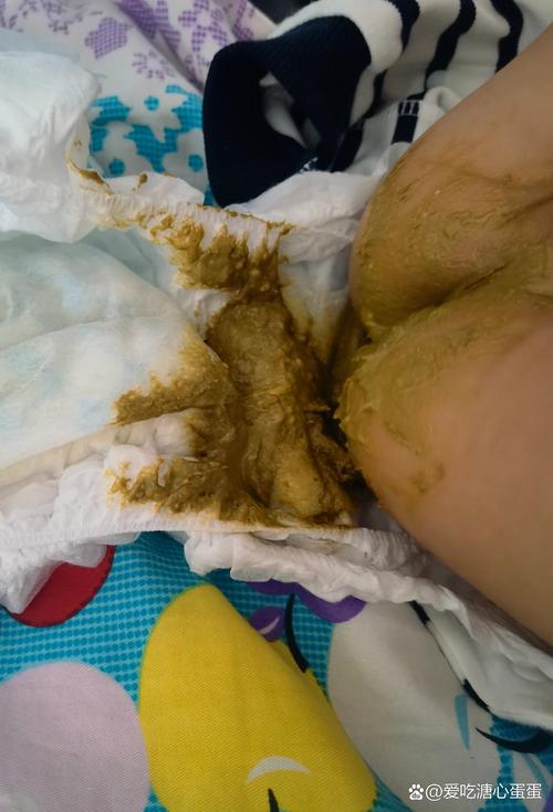 新生儿大便呈块状是消化不良还是喂养方式出了问题？-第3张图片-郑州医学网