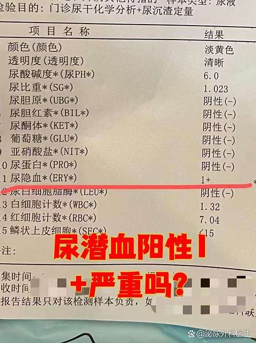 孕期尿检隐血3个加号-第1张图片-郑州医学网 孕期尿检隐血3个加号-第1张图片-郑州医学网