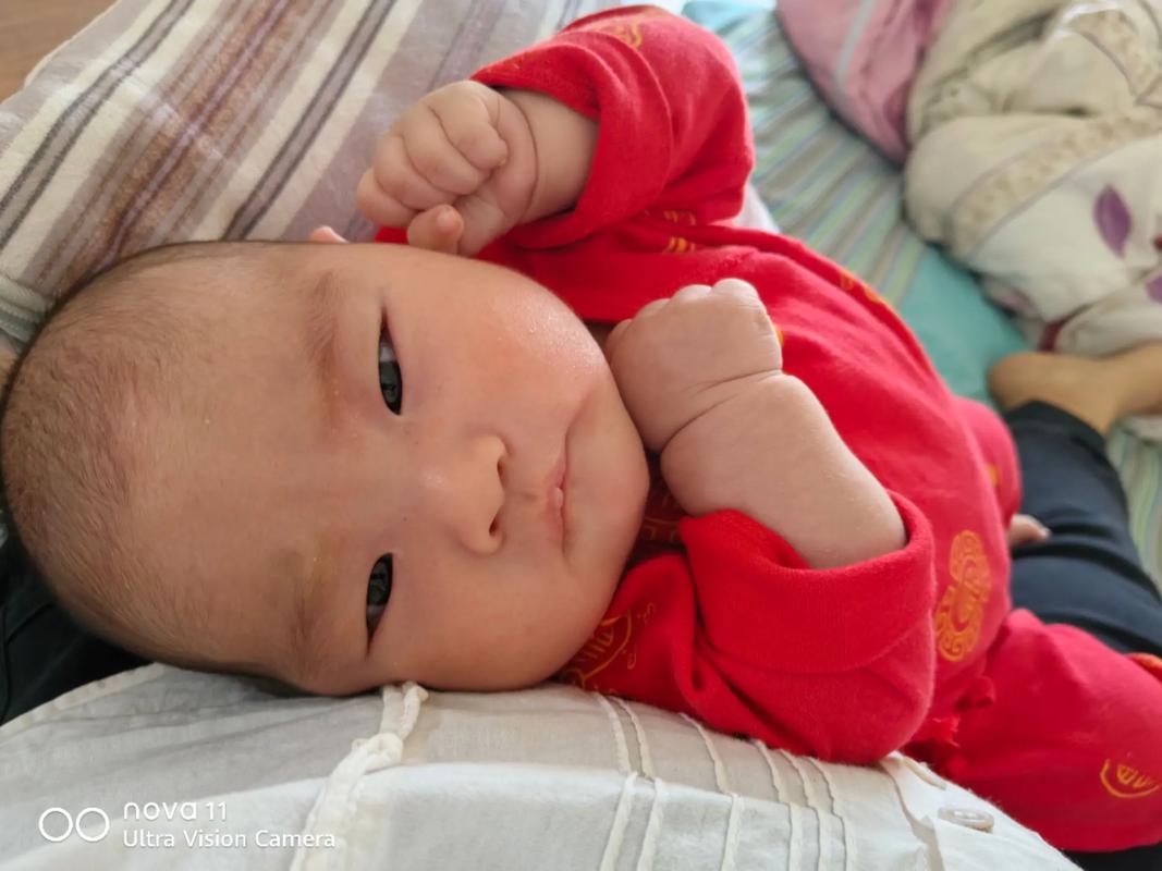 新生儿脸一块一块红色-第3张图片-郑州医学网