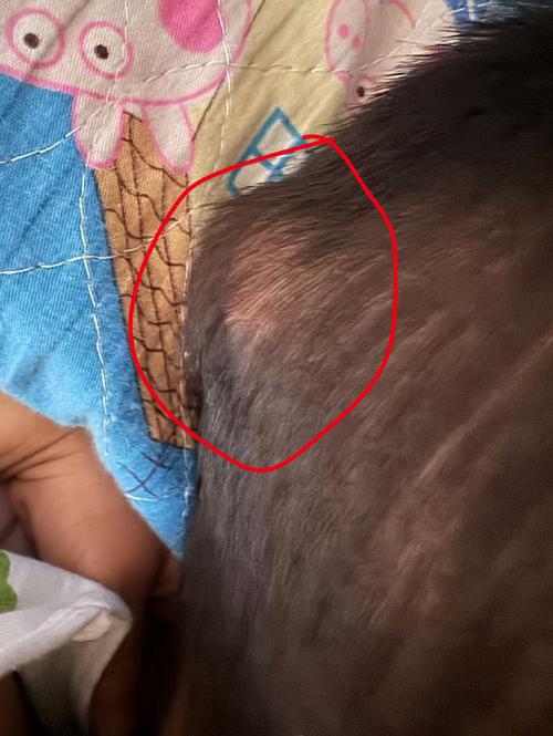 新生儿硬肿症的并发症-第2张图片-郑州医学网