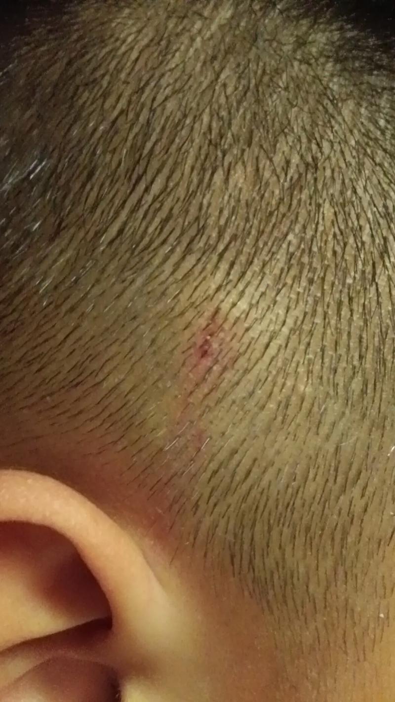 新生儿的头被打了一下-第3张图片-郑州医学网