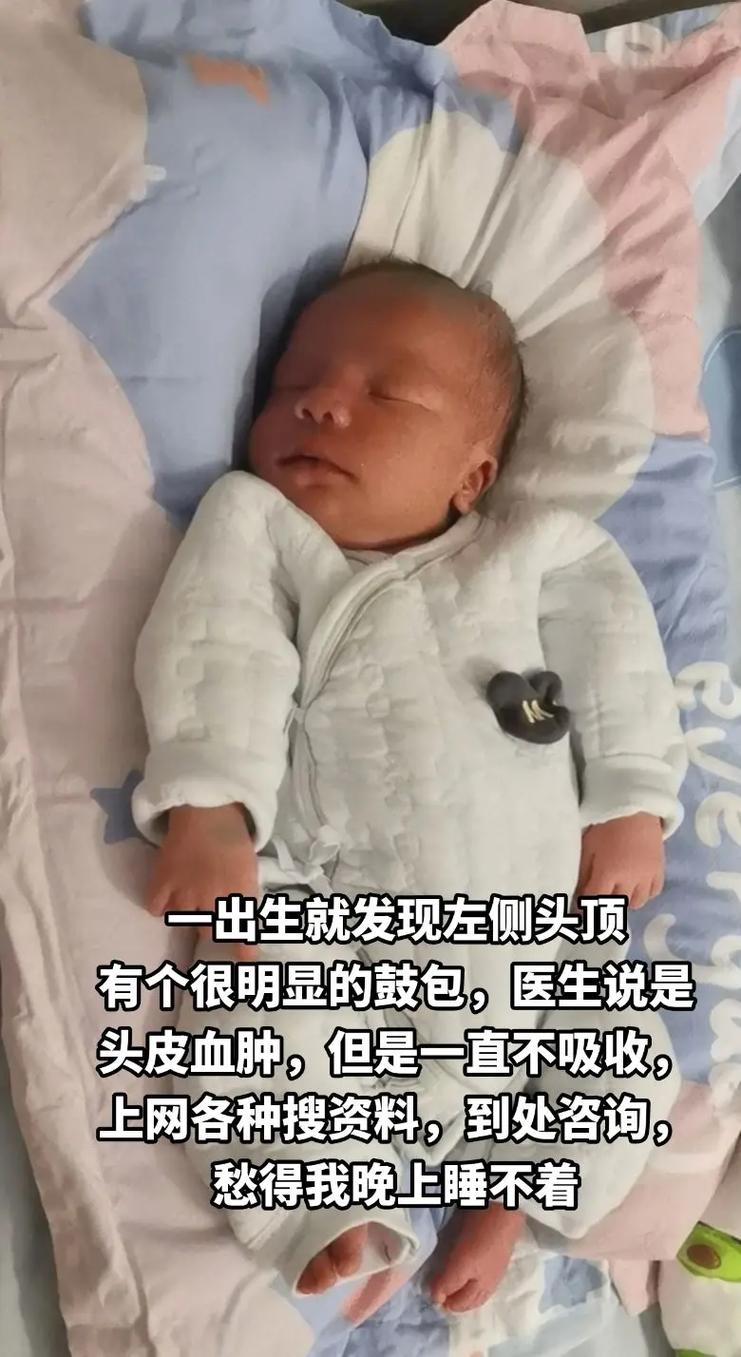 新生儿的头被打了一下-第2张图片-郑州医学网