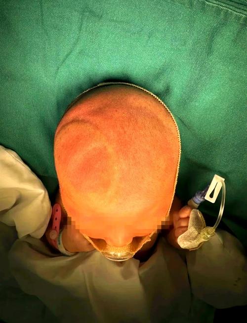 新生儿脑膜炎有后遗症-第1张图片-郑州医学网 新生儿脑膜炎有后遗症-第1张图片-郑州医学网