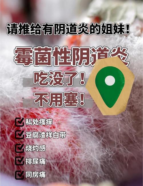 孕期霉菌反复能用药么-第2张图片-郑州医学网