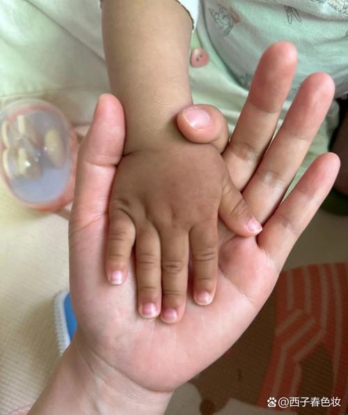 新生儿手白怎么回事啊-第2张图片-郑州医学网