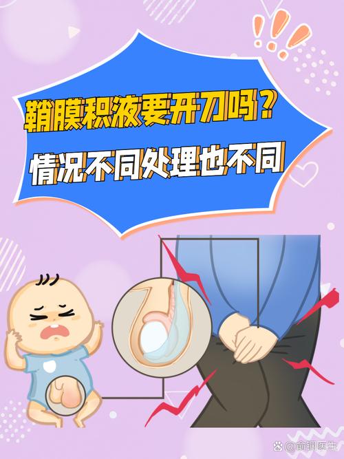 新生儿双侧硬膜下积液，病因、诊断与治疗全解析-第2张图片-郑州医学网